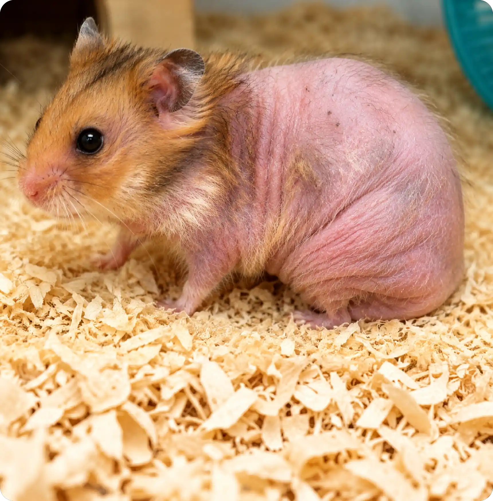 Hormonal Alopecia